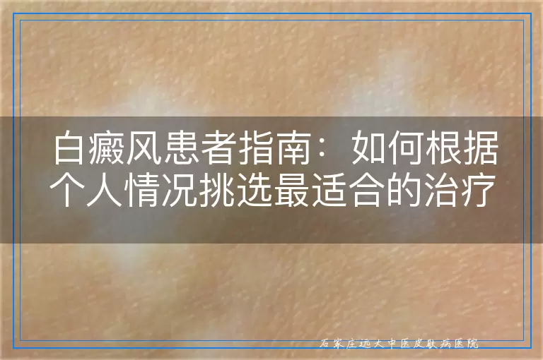 白癜风患者指南：如何根据个人情况挑选最适合的治疗方法
