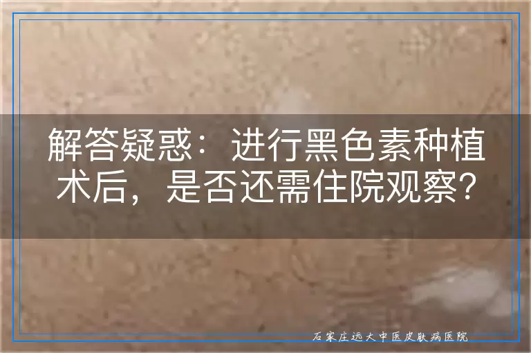 解答疑惑：进行黑色素种植术后，是否还需住院观察？