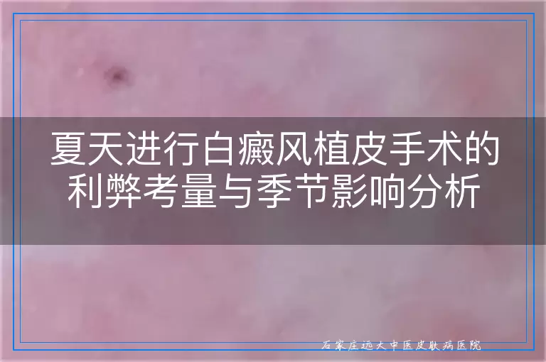 夏天进行白癜风植皮手术的利弊考量与季节影响分析