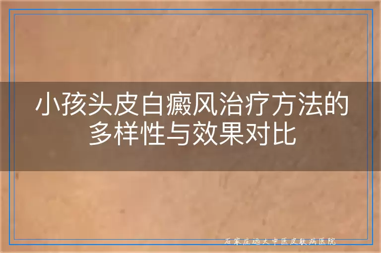 小孩头皮白癜风治疗方法的多样性与效果对比