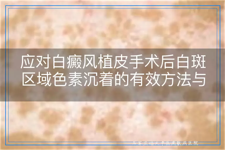 应对白癜风植皮手术后白斑区域色素沉着的有效方法与建议