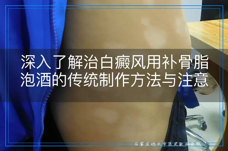 深入了解治白癜风用补骨脂泡酒的传统制作方法与注意事项