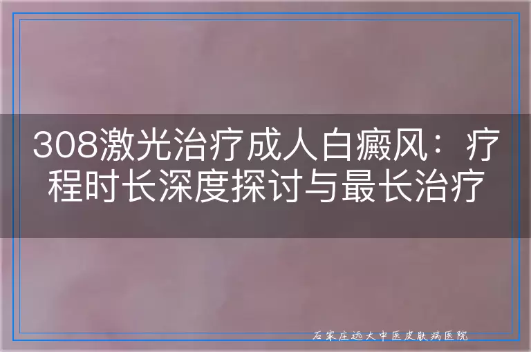 308激光治疗成人白癜风：疗程时长深度探讨与最长治疗周期揭秘