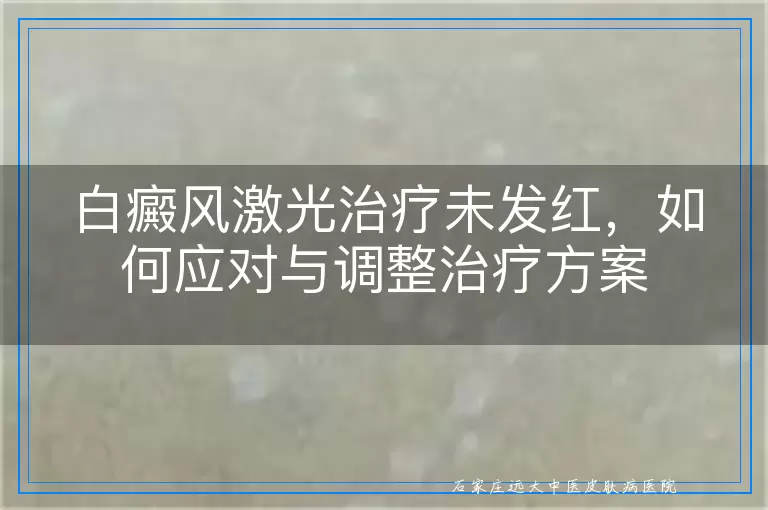 白癜风激光治疗未发红，如何应对与调整治疗方案