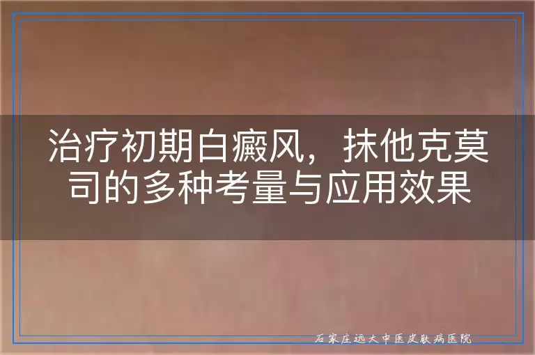 治疗初期白癜风，抹他克莫司的多种考量与应用效果