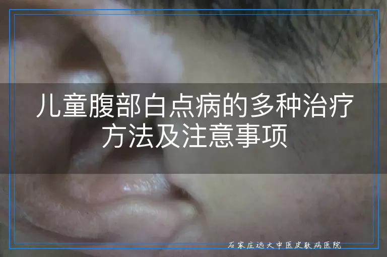儿童腹部白点病的多种治疗方法及注意事项