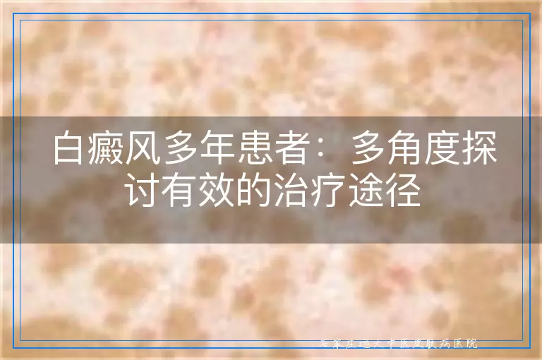 白癜风多年患者：多角度探讨有效的治疗途径