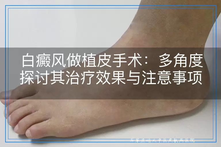 白癜风做植皮手术：多角度探讨其治疗效果与注意事项