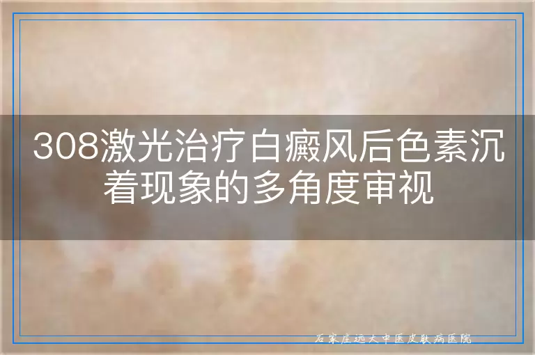 308激光治疗白癜风后色素沉着现象的多角度审视