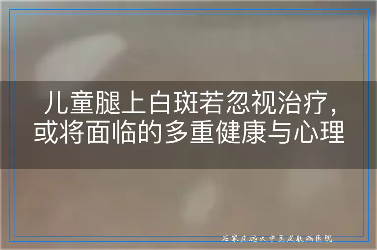 儿童腿上白斑若忽视治疗，或将面临的多重健康与心理挑战