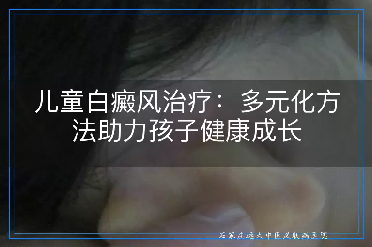 儿童白癜风治疗：多元化方法助力孩子健康成长