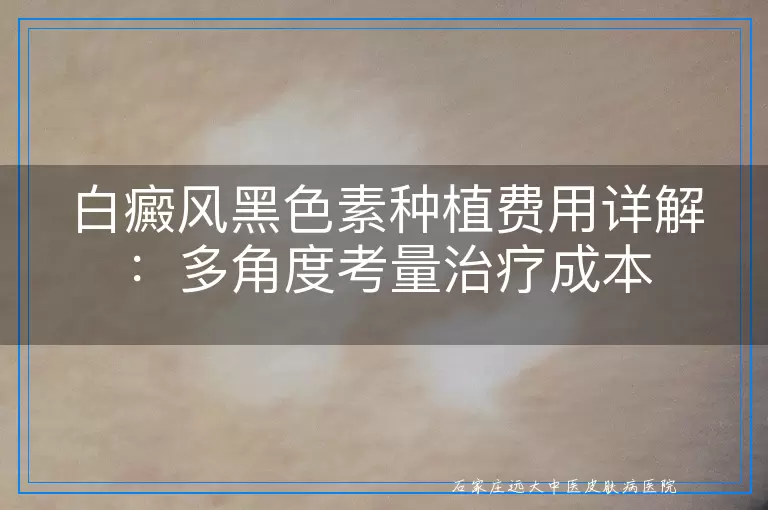 白癜风黑色素种植费用详解：多角度考量治疗成本