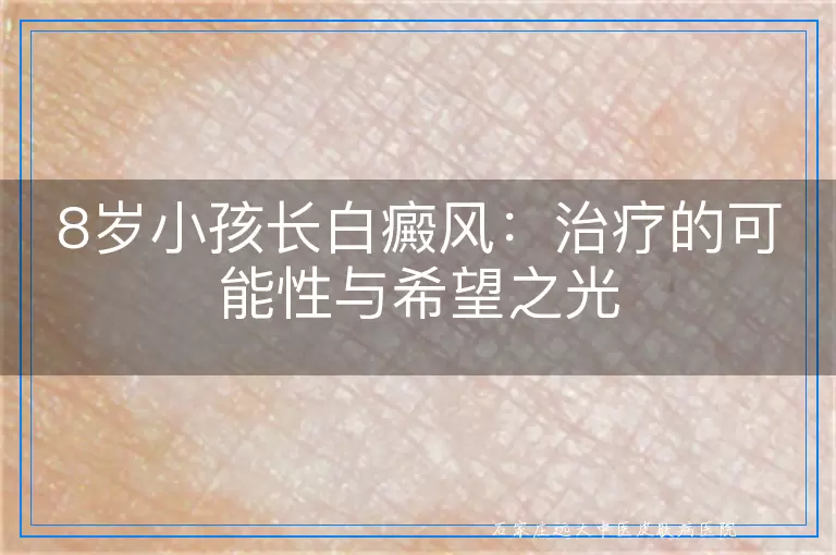 8岁小孩长白癜风：治疗的可能性与希望之光