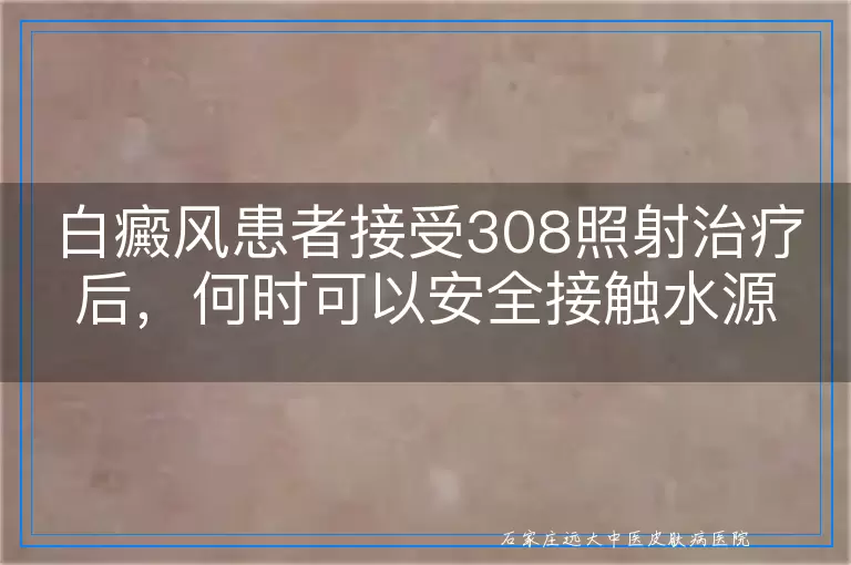 白癜风患者接受308照射治疗后，何时可以安全接触水源？