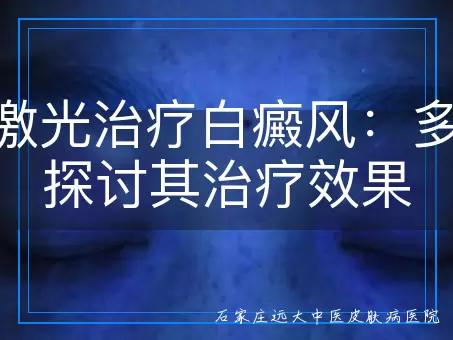 308激光治疗白癜风：多角度探讨其治疗效果