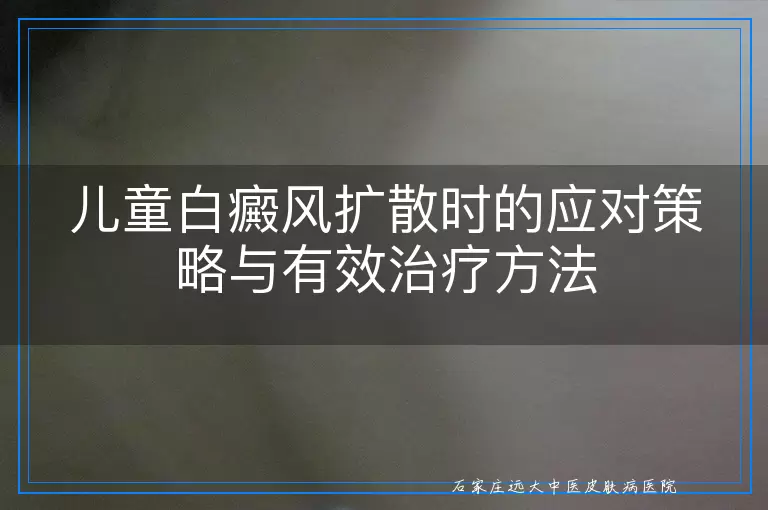 儿童白癜风扩散时的应对策略与有效治疗方法