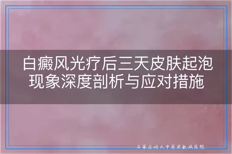 白癜风光疗后三天皮肤起泡现象深度剖析与应对措施