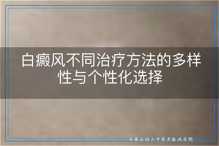 白癜风不同治疗方法的多样性与个性化选择