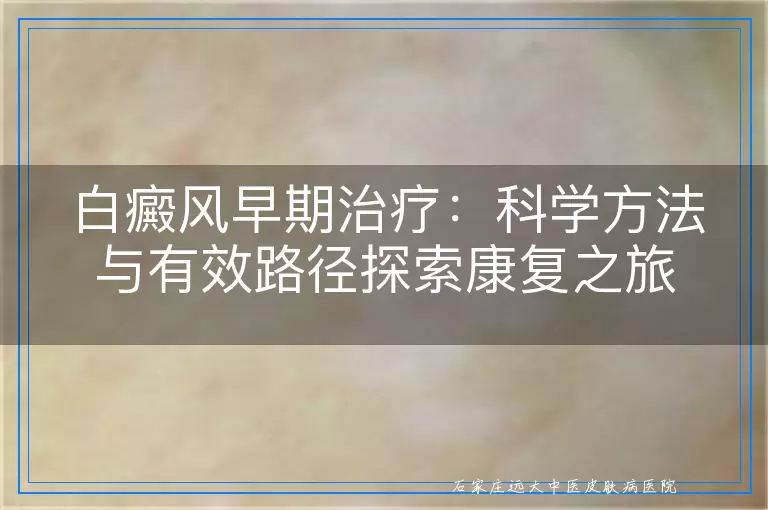 白癜风早期治疗：科学方法与有效路径探索康复之旅
