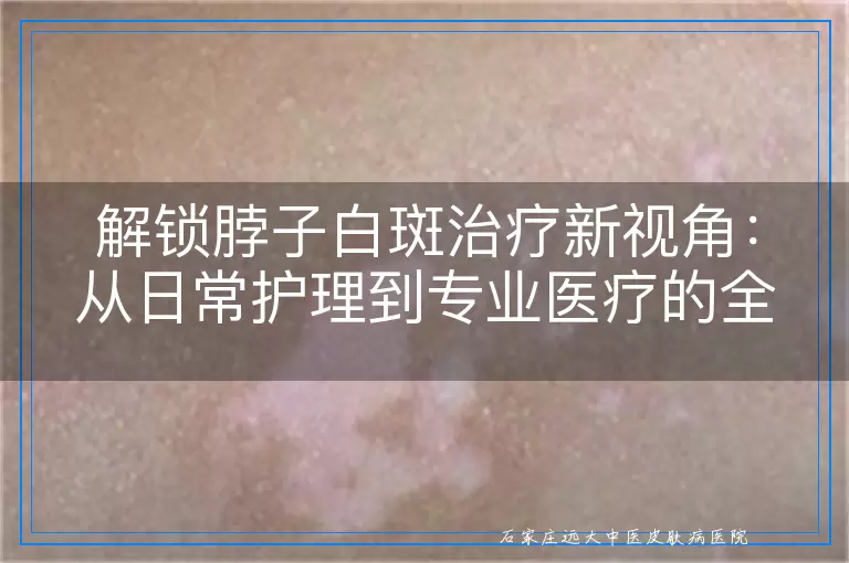 解锁脖子白斑治疗新视角：从日常护理到专业医疗的全面应对方案