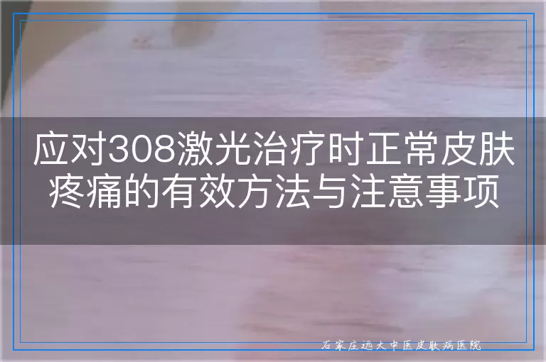 应对308激光治疗时正常皮肤疼痛的有效方法与注意事项：为白癜风患者提供实用指南