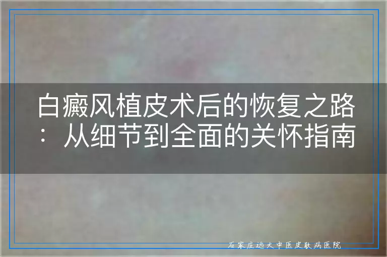 白癜风植皮术后的恢复之路：从细节到全面的关怀指南