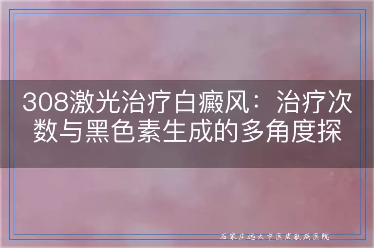 308激光治疗白癜风：治疗次数与黑色素生成的多角度探讨