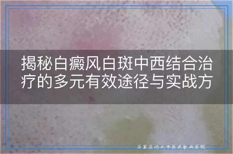 揭秘白癜风白斑中西结合治疗的多元有效途径与实战方法