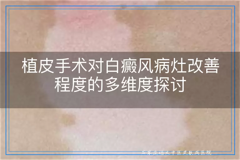 植皮手术对白癜风病灶改善程度的多维度探讨