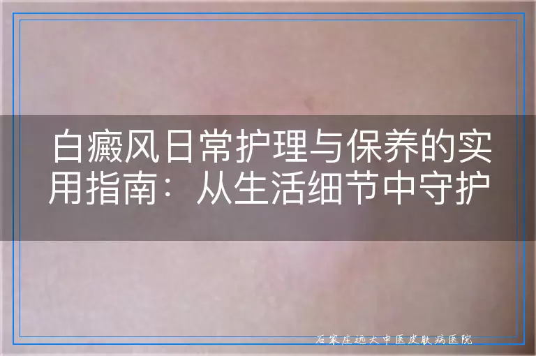 白癜风日常护理与保养的实用指南：从生活细节中守护肌肤健康