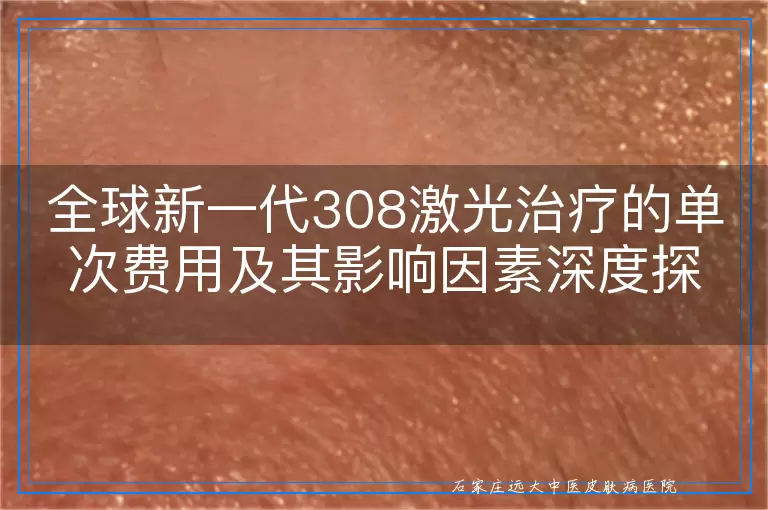 全球新一代308激光治疗的单次费用及其影响因素深度探讨