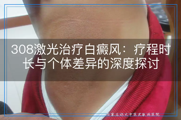 深入剖析：白癜风患者接受308激光治疗为何病灶反而扩大？