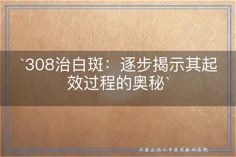 308治白斑：逐步揭示其起效过程的奥秘
