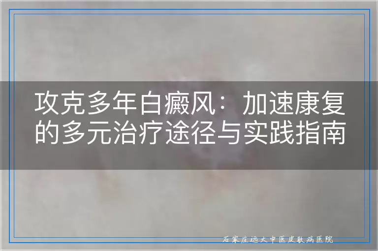 攻克多年白癜风：加速康复的多元治疗途径与实践指南