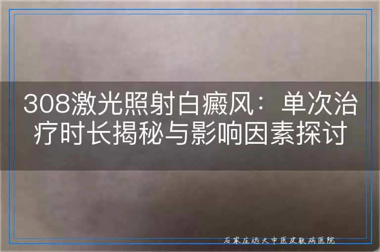 308激光照射白癜风：单次治疗时长揭秘与影响因素探讨