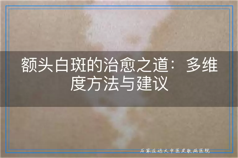 额头白斑的治愈之道：多维度方法与建议