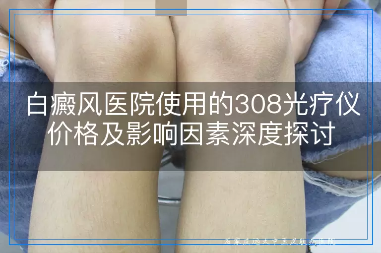 白癜风医院使用的308光疗仪价格及影响因素深度探讨