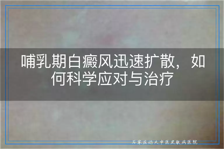 深入剖析：白癜风颜色很白时，激光治疗是否真的有效？