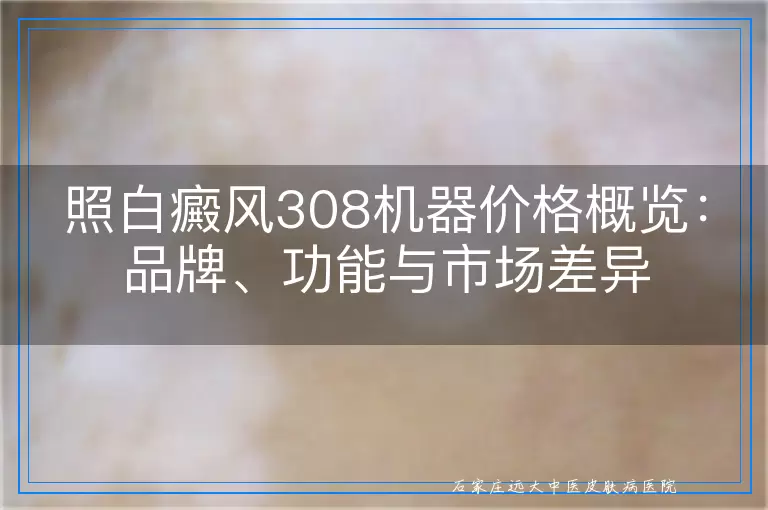 照白癜风308机器价格概览：品牌、功能与市场差异