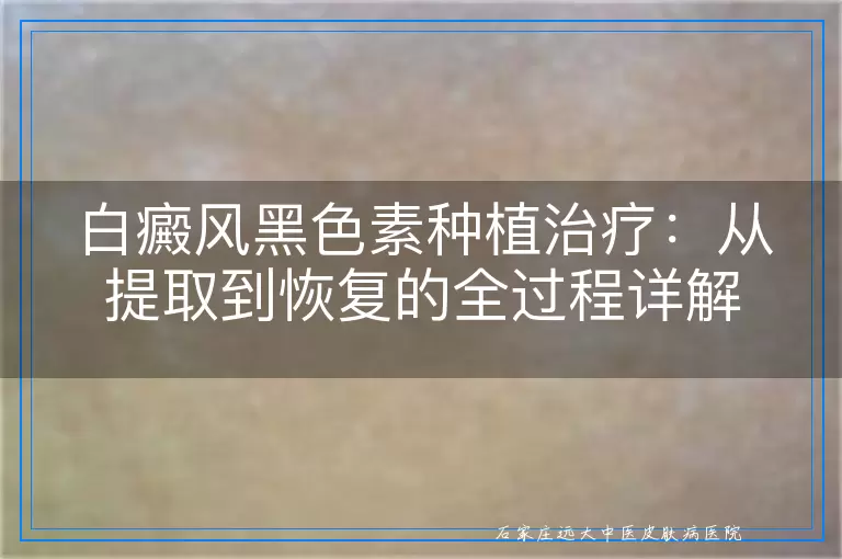 白癜风黑色素种植治疗：从提取到恢复的全过程详解