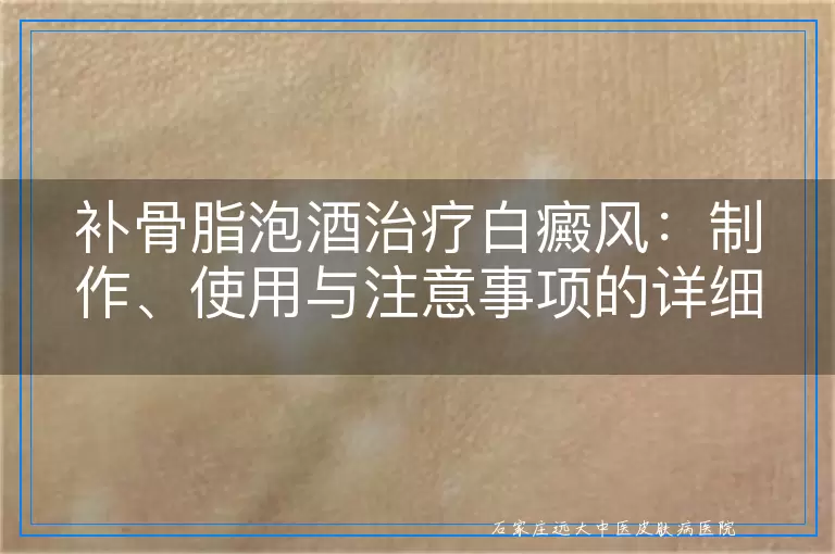 补骨脂泡酒治疗白癜风：制作、使用与注意事项的详细指南