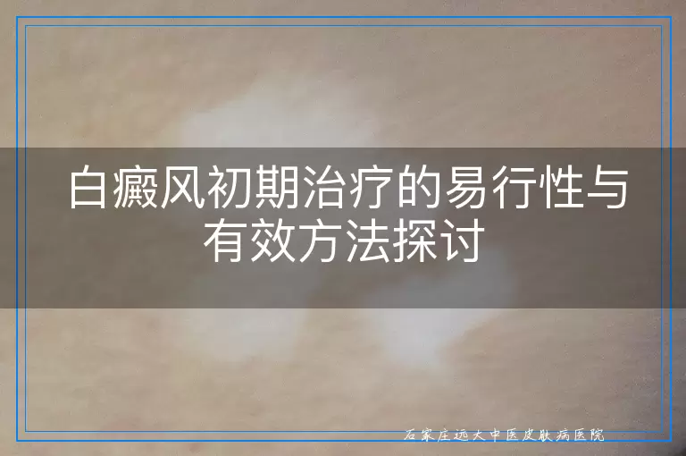 白癜风初期治疗的易行性与有效方法探讨