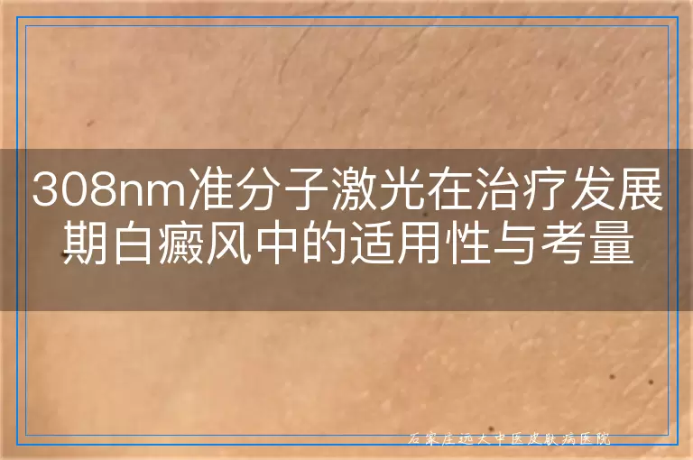 308nm准分子激光在治疗发展期白癜风中的适用性与考量