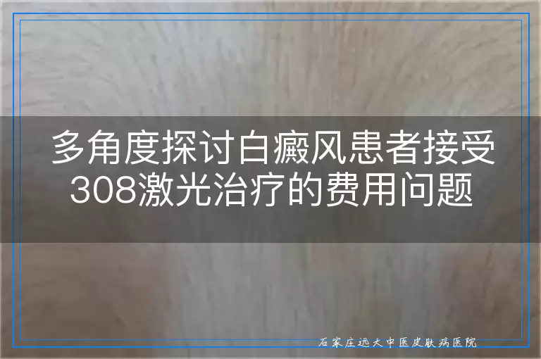 多角度探讨白癜风患者接受308激光治疗的费用问题