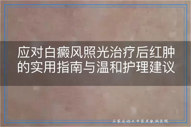 应对白癜风照光治疗后红肿的实用指南与温和护理建议