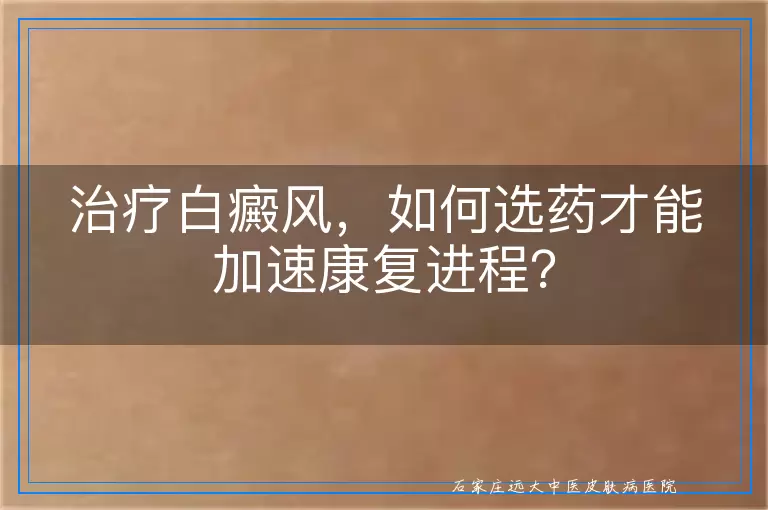 治疗白癜风，如何选药才能加速康复进程？