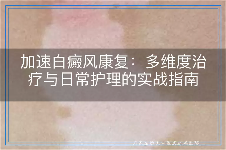 加速白癜风康复：多维度治疗与日常护理的实战指南