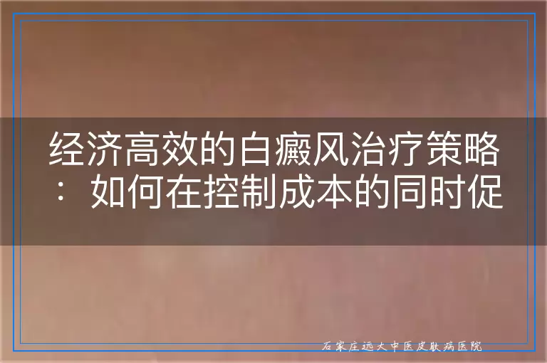 经济高效的白癜风治疗策略：如何在控制成本的同时促进康复