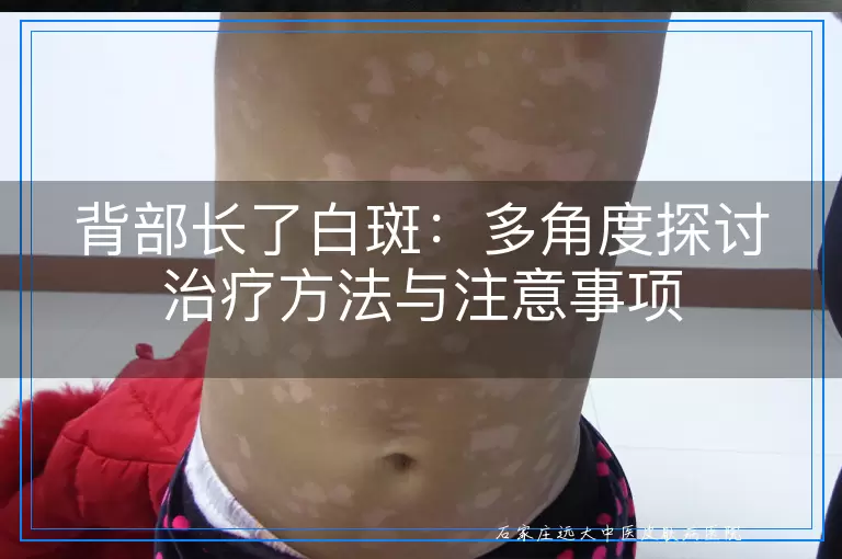 背部长了白斑：多角度探讨治疗方法与注意事项