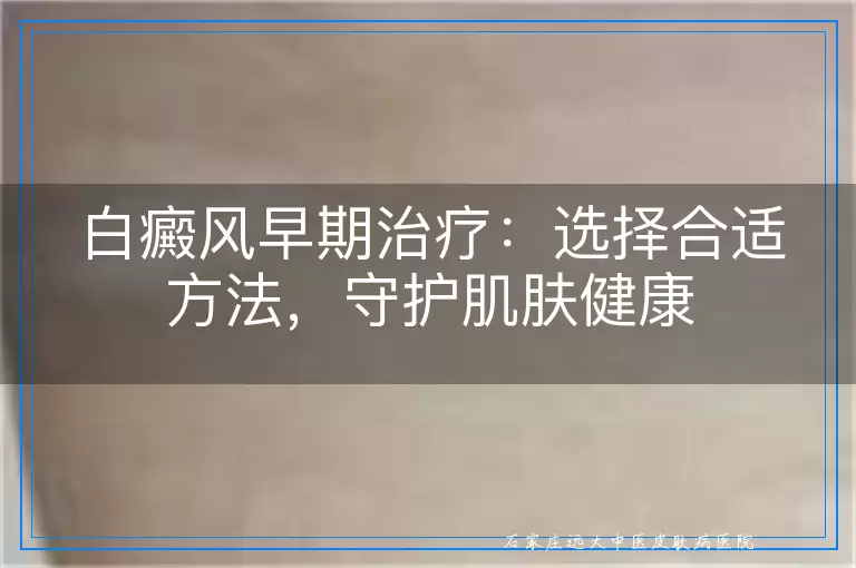 白癜风早期治疗：选择合适方法，守护肌肤健康